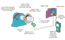 1706A