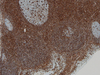 CONFIRM Vimentin - 790-2917 - Ventana Medical Systems, Inc.