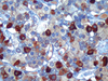Thyroid Stimulating Hormone (TSH) - 760-2709 - Ventana Medical Systems, Inc.