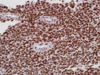 INI-1 - 760-4615 - Ventana Medical Systems, Inc.