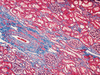 Trichrome III Blue Staining Kit - 860-022 - Ventana Medical Systems, Inc.