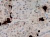 Somatostatin - 760-2667 - Ventana Medical Systems, Inc.