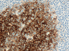 CD10 - 790-4506 - Ventana Medical Systems, Inc.
