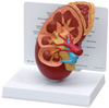 Normal Kidney Model - B3250 - Parco Scientific Company