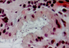 Genta Triple Stain For Helicobacter Pylori & Gastric Morphology - k087 - Poly Scientific
