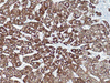HSA (Hepatocyte Specific Antigen) - 760-4350 - Ventana Medical Systems, Inc.