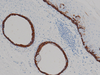 Cytokeratin 14 - 760-4251 - Ventana Medical Systems, Inc.
