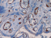 Factor VIII Related Antigen - 760-2642 - Ventana Medical Systems, Inc.