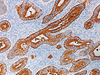 Carcinoembryonic Antigen (CEA) - 760-2507 - Ventana Medical Systems, Inc.