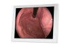 MM-8.4S TRU-Vu Medical-Grade LCD Monitor