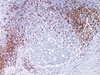 CD2 - 760-4377 - Ventana Medical Systems, Inc.