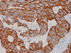 Cytokeratin 19 - 760-4281 - Ventana Medical Systems, Inc.