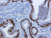 CONFIRM p53 - 790-2912 - Ventana Medical Systems, Inc.