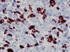 Macrophage - 760-2657 - Ventana Medical Systems, Inc.