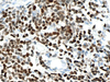Cyclin D1 - 790-4508 - Ventana Medical Systems, Inc.