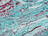 Trichrome III Green Staining Kit - 860-023 - Ventana Medical Systems, Inc.