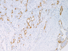 Mesothelial Cell - 760-4445 - Ventana Medical Systems, Inc.