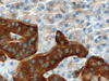 CONFIRM Synaptophysin - 790-4407 - Ventana Medical Systems, Inc.