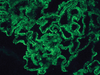 IgG (Immunoglobulin G), FITC - 760-2680 - Ventana Medical Systems, Inc.