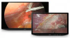 LMD-XH550MT Sony 4K Surgical LCD Display
