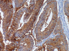 Ep-CAM (Epithelial Specific Antigen) - 760-4383 - Ventana Medical Systems, Inc.