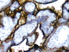 Placental Alkaline Phosphatase (PLAP) - 760-2664 - Ventana Medical Systems, Inc.