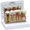 Teeth Model with Pathologies - B2860 - Parco Scientific Company