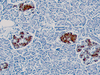 Insulin - 760-2655 - Ventana Medical Systems, Inc.