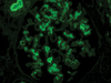 IgA (Immunoglobulin A), FITC - 760-2681 - Ventana Medical Systems, Inc.