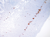PGP 9.5 - 760-4434 - Ventana Medical Systems, Inc.