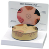 Skin Cancer Model - B3850 - Parco Scientific Company