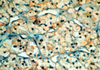 Oil Red O in Propylene Glycol Method for Fats - k043 - Poly Scientific