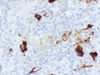 Fascin - 760-2702 - Ventana Medical Systems, Inc.