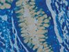 Alcian Yellow Staining Kit - 860-017 - Ventana Medical Systems, Inc.