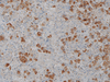 Adrenocorticotropin (ACTH) - 760-2708 - Ventana Medical Systems, Inc.