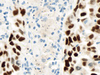 CONFIRM Thyroid Transcription Factor-1 (TTF-1) - 790-4398 - Ventana Medical Systems, Inc.