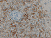 CD45R - 760-2624 - Ventana Medical Systems, Inc.
