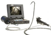 Portable Videoscope System, V-Series -- VSBx
