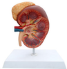 Kidney Model with Adrenal Gland - B10424 - Parco Scientific Company