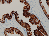 CONFIRM Cytokeratin - 760-2521 - Ventana Medical Systems, Inc.