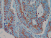 COX-2 (Cyclooxygenase 2) - 760-4254 - Ventana Medical Systems, Inc.