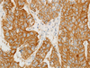 CONFIRM EGFR (Epidermal Growth Factor Receptor) - 790-4347 - Ventana Medical Systems, Inc.
