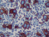 CONFIRM CD30 - 790-2926 - Ventana Medical Systems, Inc.