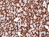 Androgen Receptor - 760-4605 - Ventana Medical Systems, Inc.