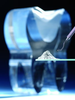 Dental Glass