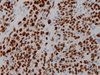 Myogenin - 760-2832 - Ventana Medical Systems, Inc.