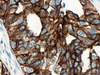 CONFIRM Cytokeratin 7 - 790-4462 - Ventana Medical Systems, Inc.