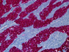 Melanoma Triple Cocktail - 790-4677 - Ventana Medical Systems, Inc.