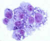 May Grunwald Giemsa Stain for Nuclear Elements - k038 - Poly Scientific