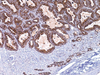 Napsin A - 760-4446 - Ventana Medical Systems, Inc.